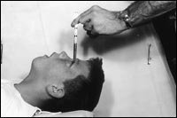 Dr. Walter Freeman performing lobotomy on Howard Dully